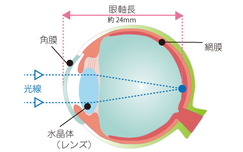 正視眼